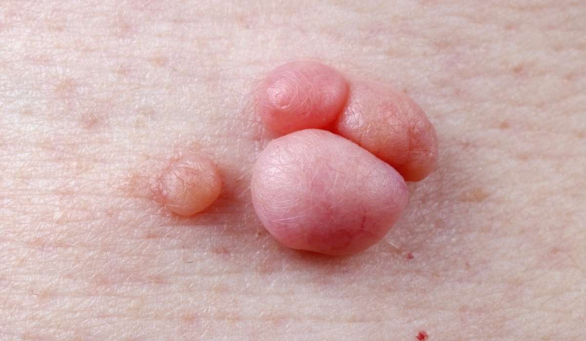 קרדיט תמונה קנבה